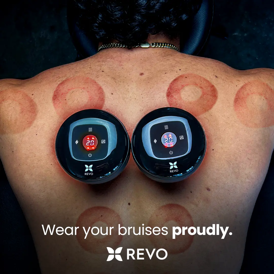 REVO The Original Smart Cupper Device, Red Light + Heat + Suction Therapy | Muscle Relief, Cellulite & Recovery | Choose from 1x / 2x / 4x + Free Kits