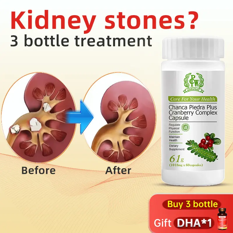PCW Pearl Grass Anti-Stone Dietary Healthcare Tablets (60 Capsules/Bottle) with Pearl Grass & Korean Thistle, for Kidney/Gallstone Dissolution & Excretion, Liver-Kidney Support & Diuretic Benefits