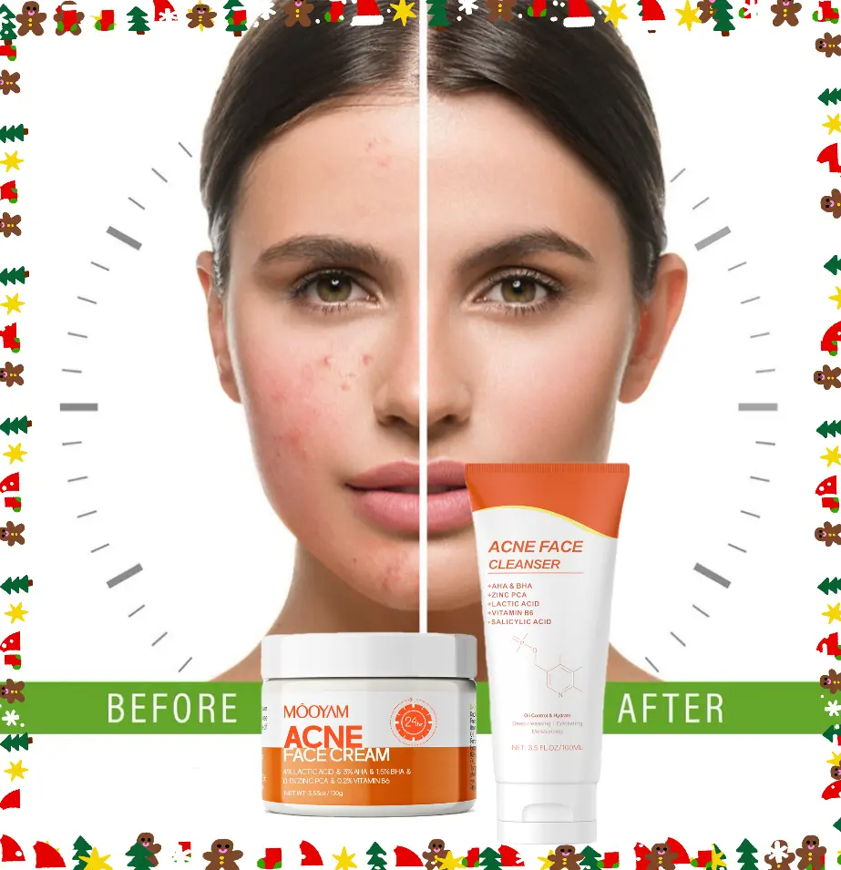【MOOYAM】【FDA】Acne Scar Treatment Cream, 3.5oz - Centella & Snail Repair, Fragrance-Free, Paraben-Free Salicylic Acid Formula - Anti-Blemish, Blemish Remover, Centella Acne Treatments for Post-Acne Marks Removal, Anti-Blemish Acne Treatments