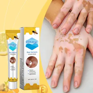 South Moon Vitiligo Treatment Cream Skin Pigment Corrector Moisturizing Nourishing Skincare Cream