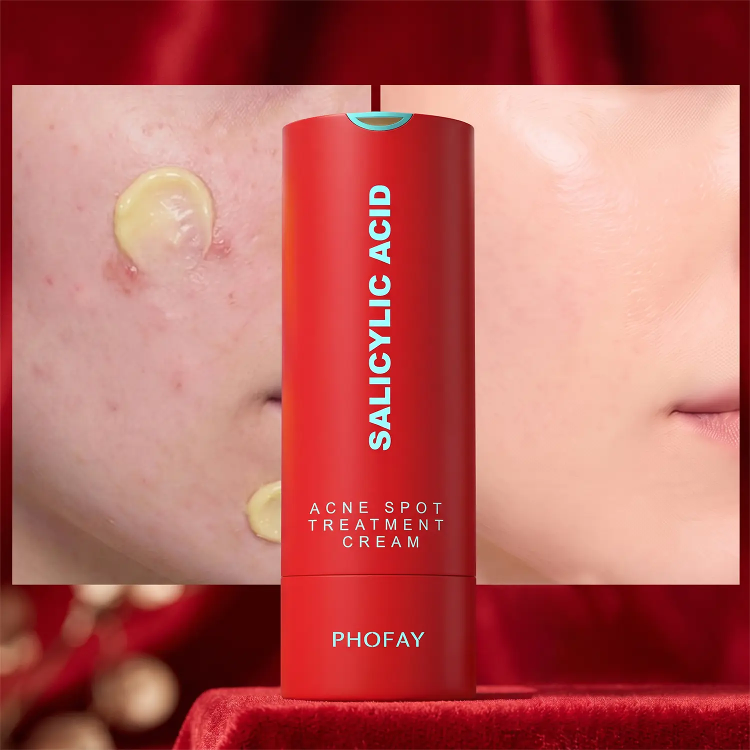 Acne Care Face Serum & Cream Set Clarifying Hydrating Lightweight Daily Skincare Duo for Acne Prone Skin
