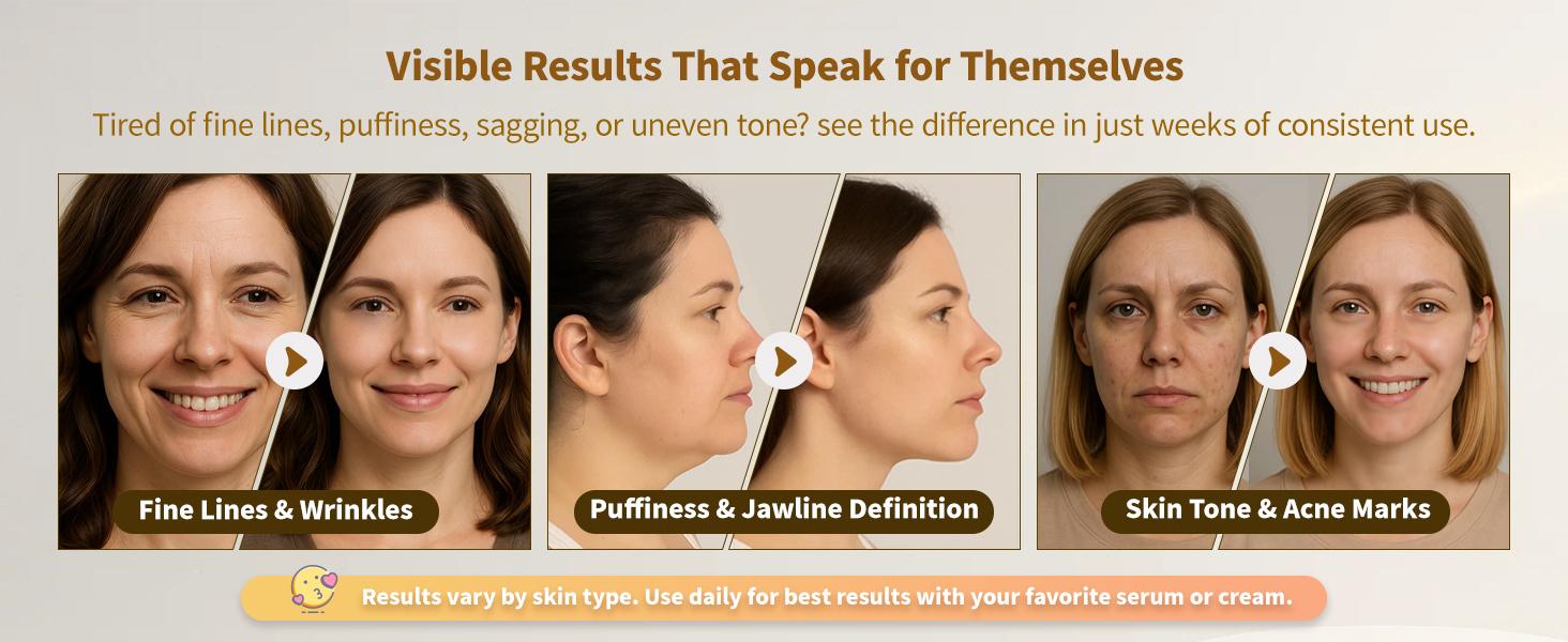 Yuonry 6-in-1 Age-Defying - Eye, Face & Neck Lift & Firm, 5-Color Light Therapy for Face with Microcurrent, Vibration, Heat & Cooling, Skin Care Tool for Youthful & Tightening Skin (Purple)