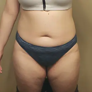 Product Review of Shapellx AirSlim Lace Steel Boned Shapewear for Women Butt Enhancer Tummy Tucking Shorts Womenswear Comfort Fajas Colombianas Basic Post Surgery from S**n