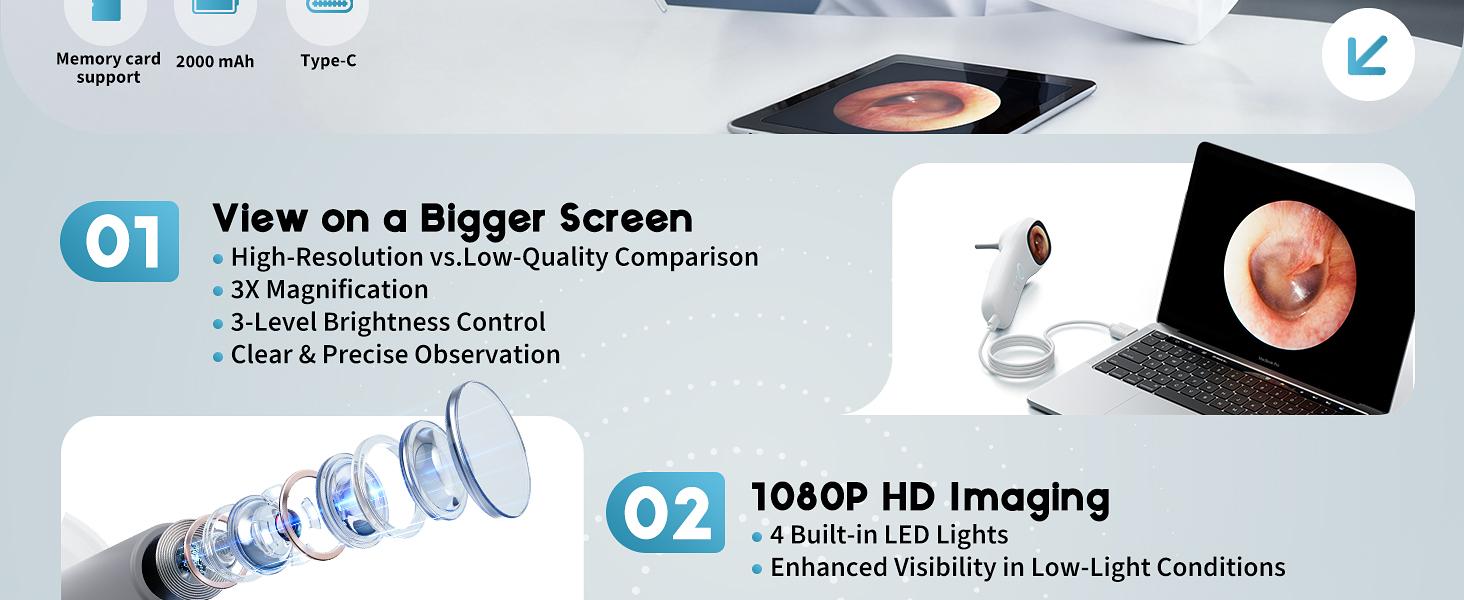 Otoscope Ear Camera with 1.21” Screen, 1080P Ear Scope with 4 LED Lights, Otoscope Camera for Adults Kids and Pets, Support Photo & Video, Type-C Charging with Computers, Baby Essentials, Home Medical