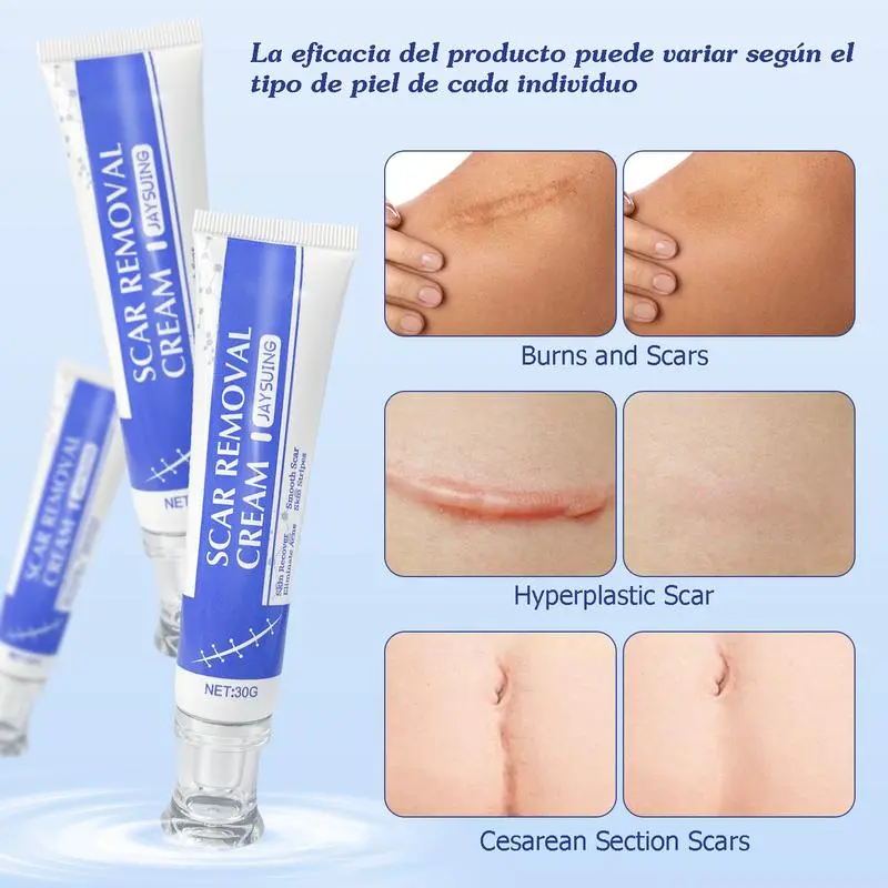 Professional Scar Removal Cream, Advanced Silicone Skin Repair Gel for Burn,Acne Old Scar Removal Cream for Face & Body  Fades Dark Scars