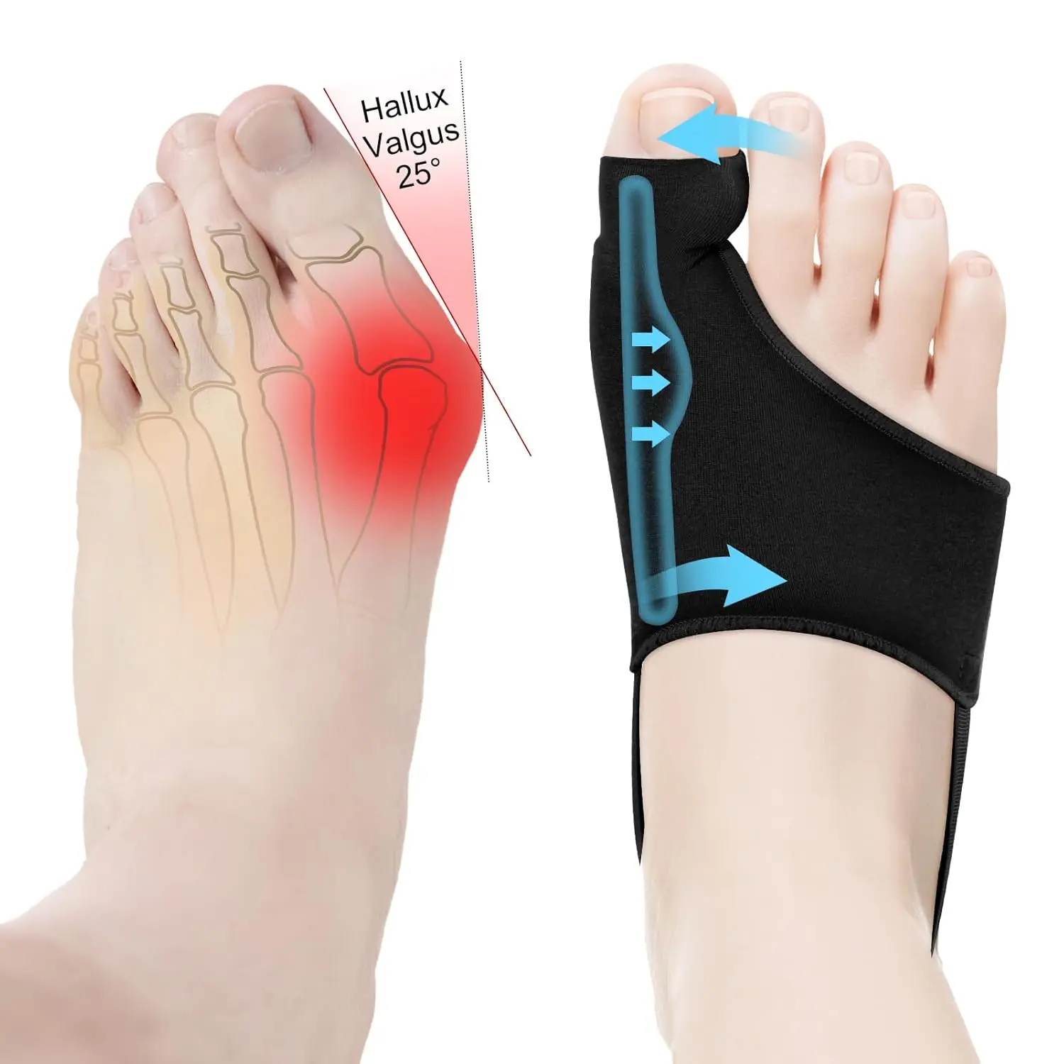 Bunion Corrector for Women & Men - Big Toe Straightener with Bunion Splint, Comfortable & Breathable for Day/Night Wear, Effective Hallux Valgus Pain Relief (2, Black)