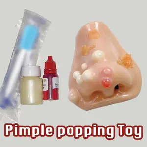 Gross Pimple Squeeze Water Spray Toy – Funny Prank Game for Kids and Adults, Family Party Toy, Novelty Gift for Holiday Fun