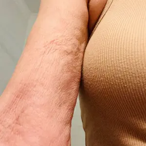 15-Day Anti Cellulite  Sculpting & Tightening  Burn Gold Massage Cream |  Cryo Thermo cellulite remover for legs ,Belly & Arm| WELLENESS，Refreshing Formula | Unisex Body Contouring Treatment for Men & Women |200 G #SummerVibes