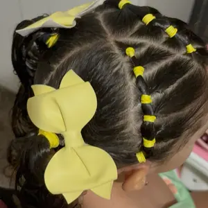 Cute Yellow Bow - As Seen in the Picture Featuring a Yellow Bow Accessory