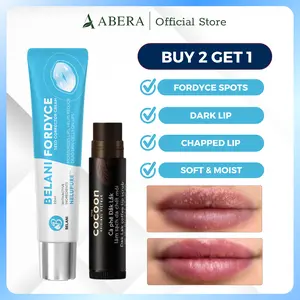 Fordyce Cream for Lips – Fordyce Spot Care, Lip Moisturizer & Repair Balm for Men, Helps Improve Dark Lips, Enriched with Nelupure & Shea Butter (0.7 Oz)