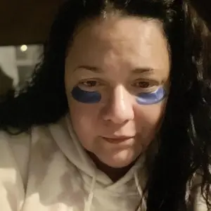 Product Review of Qure Micro-Infusion Anti Wrinkle Patches for Smile Line, Frown lines, Under Eye Bags, Puffiness, Crow's Feet - Retinol, Niacinamide, Caffeine, Peptides - Dissolvable for Overnight Use - 8 Pairs from j**❌