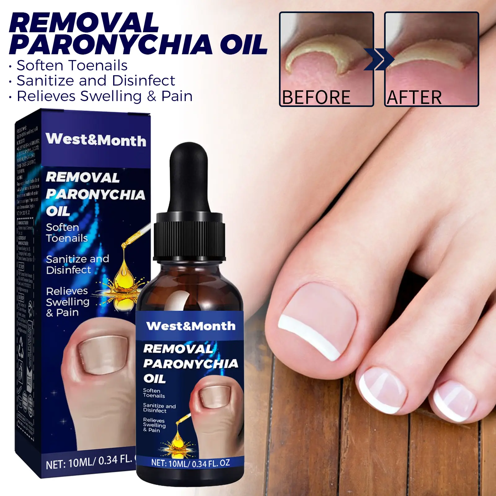 West&Month Nail Care Oil for Hands & Feet — Moisturizing nail oil for ingrown nails/thick toenails; ideal for daily nail care