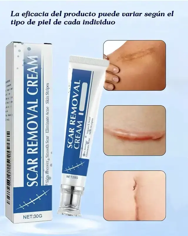Scar Repair Cream, Soothing Treatment for Fading Acne Scars, C-Sections, Burns, and Surgical Marks on Face & Body, Acne Scar Remover