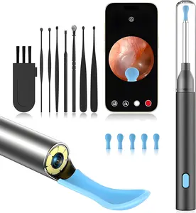 Smart Visual Ear Cleaner with 8MP HD Camera & 30FPS Otoscope - 5 Soft Silicone Tips for Safe Ear Wax Removal, USB-C Rechargeable, Up to 40min Use, Family-Friendly for iPhone & Android