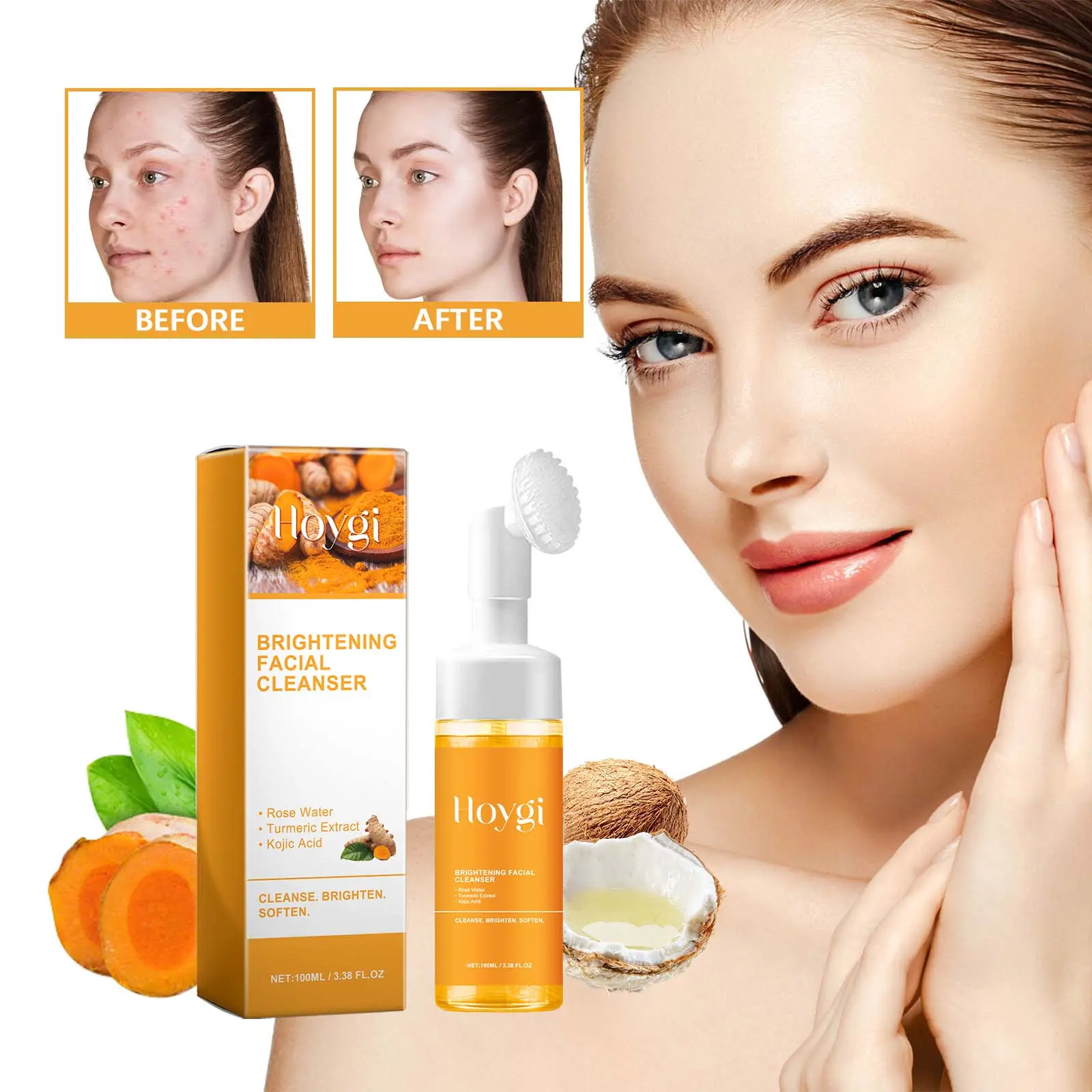 Hoygi Curcuma & Kojic Acid Facial Cleanser - Deep Cleansing Foam with Smooth, Hydrating Moisturizer Formula, Squeeze Bottle Design & Brush-Compatible for Acne Marks, Pigmentation & Brightening Nourishment, Facial Wash