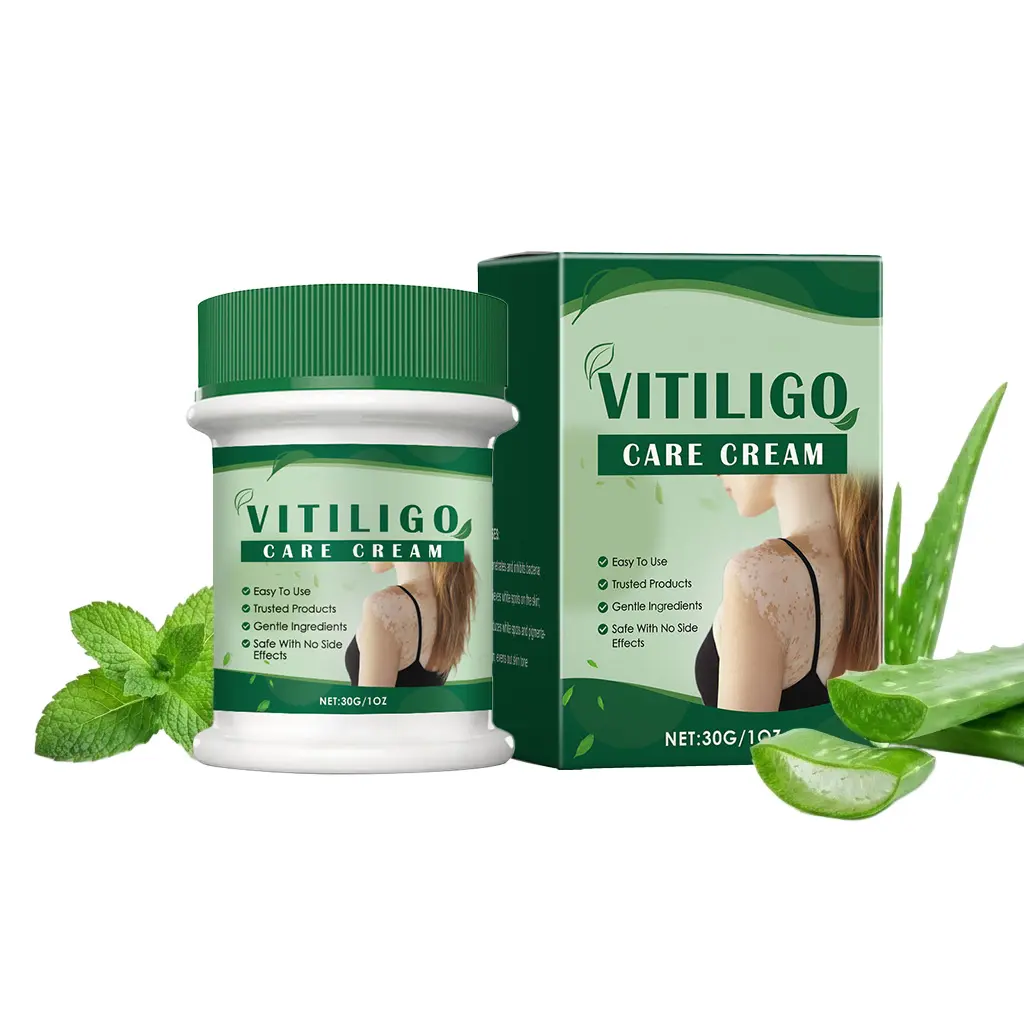 Vitiligo Treatment Cream for Calming Barrier Repair, Tone Correcting Body Moisturizer with Mint & Aloe for Dark Spots, Moisturizers, Color Correction, Smooth, Body Care, Daytime, 30G, Lightweight, Mint Leaf, Natural, Skin Repair, Dark Spot Remover, Plump
