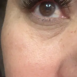 PURELEOR Lash Bond and Seal with Eyelash Remover for DIY Clusters Lashes Extension Strong Hold 72 Hours Quick Makeup Removal Suitable for Sensitive Eyes