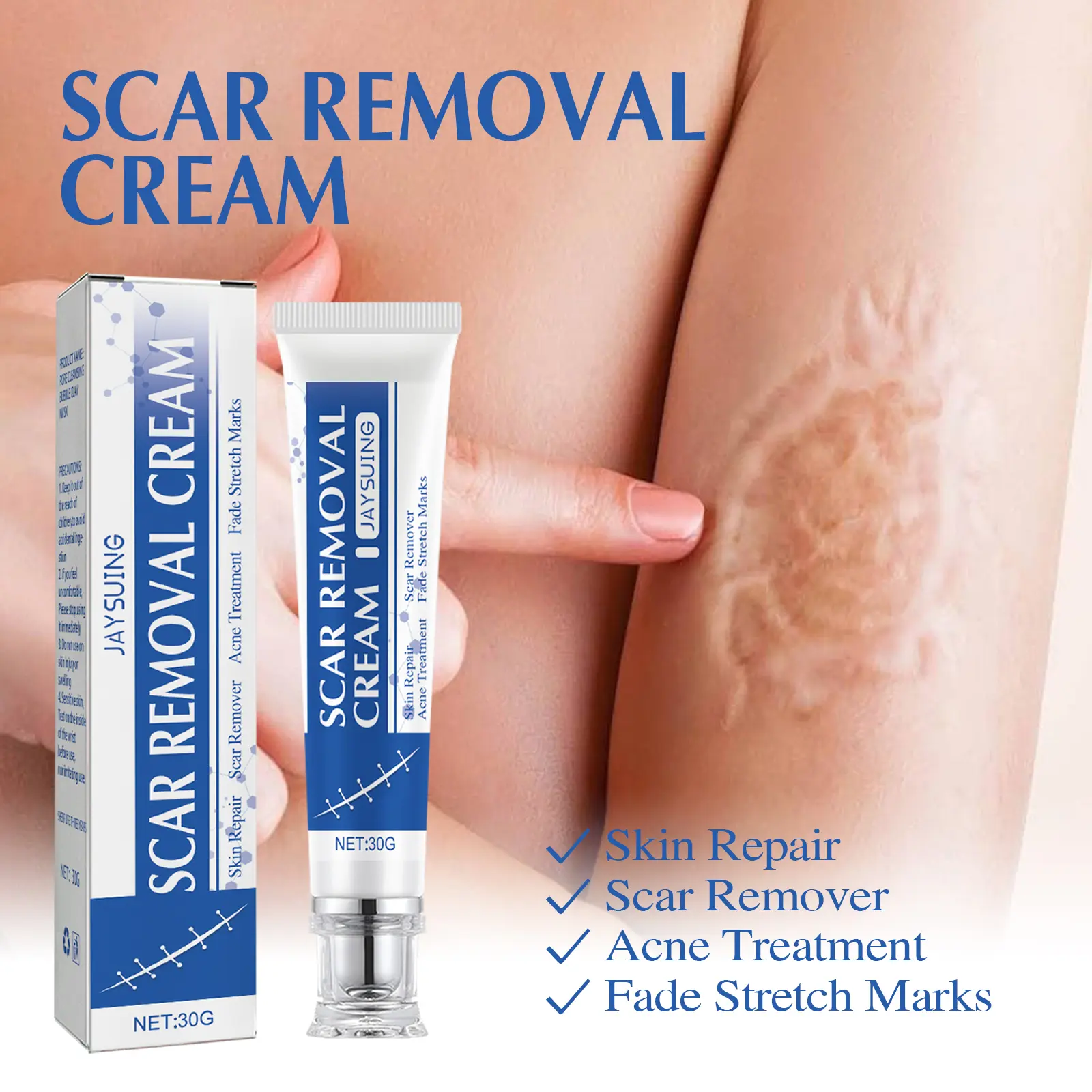 Professional Scar Removal Gel- Scarremovaltreatment for keloids, C-sectionS, surgeries,burns, acne andmore. daily massage relief discomfort