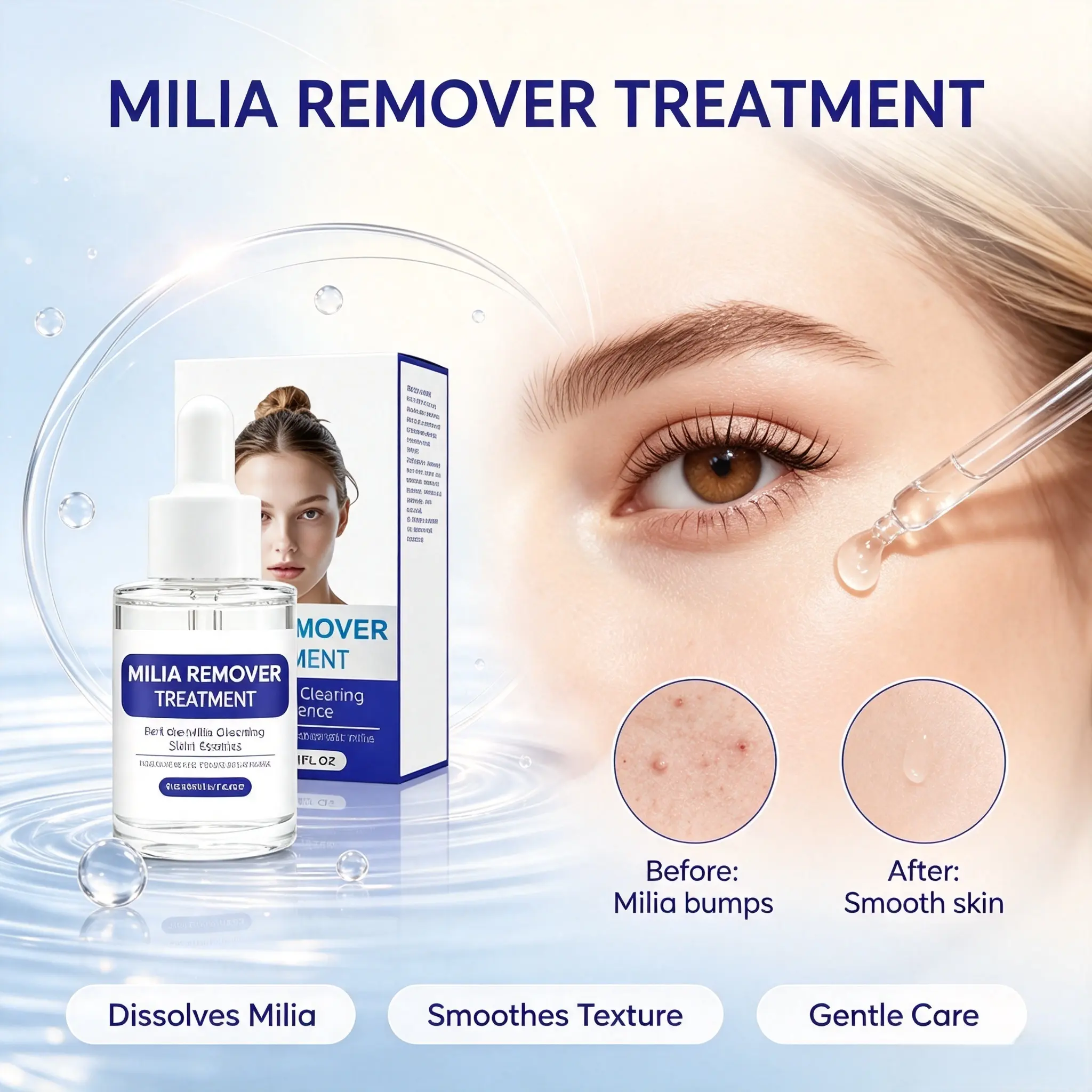 Milia Treatment Serum with Salicylic & Hyaluronic Acid, Gentle Pore Refining Blemish Treatment for Sensitive & Acne-Prone Skin, 30 ml Dropper Bottle, Salicylic Acid, Redness, Moisturizer, Skin Repair