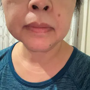 ROZINO Coconut Oil Facial Hair Removal Cream - Gentle Lip Hair Removal