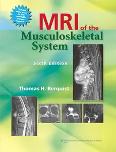 USED-MRI of the Musculoskeletal System with Access Code by Berquist, Thomas H. (Hardcover)