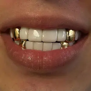 THATBOY 4pcs/Set New Style 18K Golden Plated Hip Hop Teeth Grillz With Star Cubic Zirconia Caps Micro Pave Top & Bottom Charm Grills For Men Women Jewelry, Hip Hop Style, Multi-Pack