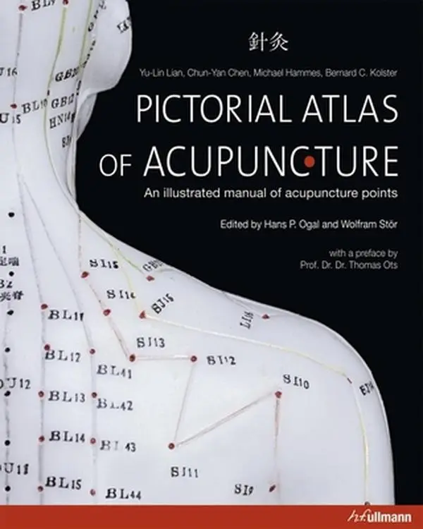 Pictorial Atlas of Acupuncture: A Practical, Experience-Based Therapeutic Illustrated Manual of Acupuncture Points - Yu-Lin Lian, Hardcover
