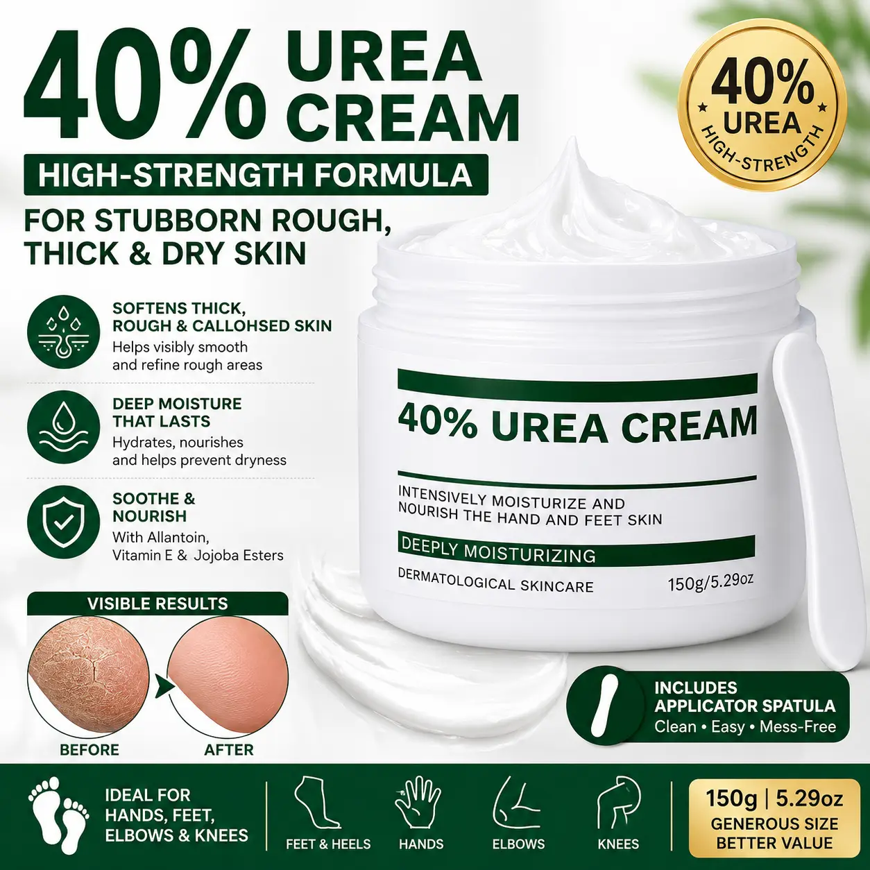 SweetSuds 40% Urea Cream 150g/5.29oz with Spatula - Intensive Moisturizing Foot & Hand Cream for Dry Cracked Heels, Callus Remover for Elbows & Knees Maximum Strength