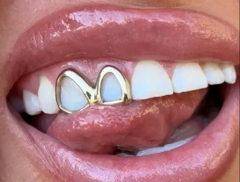 14K Gold Plated Double Open Face Grillz Set