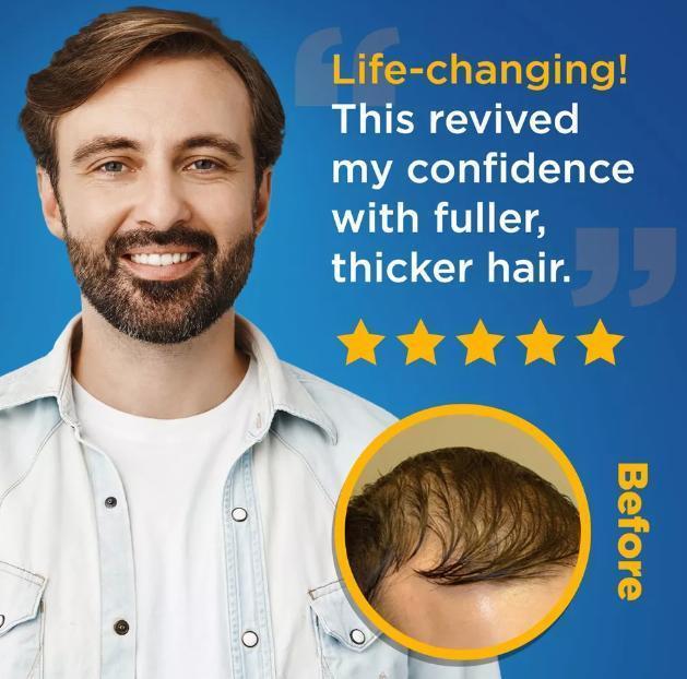 Kirkland 5% Minoxidil Topical Solution for Men & Women | Scalp Care for Thin & Uneven Hair 3-Month Supply, Revitalizes Hair Follicles, Boosts Hair Volume & Restores Thick Healthy Hair, Skin Lab Tested