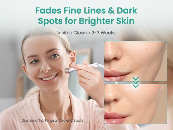 UNOISETION Diamond Microdermabrasion Machine- 3 in 1 Professional Facial Microdermabrasion Tool for Exfoliation & Blackhead Removal for Home Use Skin Care, Reduces Fine Lines, Boosts Serum Absorption