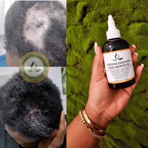 Herbalist Careology - Goddess Strength Hair Growth Oil - Hair Growth Oil for FAST Results with Indigenous Herbs to Regrowth, Alopecia, Thinning Edges, Bold Spots, Stagnant Growth Natural Haircare  for All Hair Types