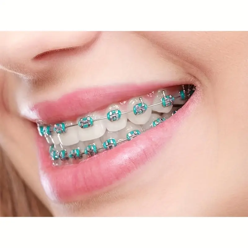 2025 Colorful Temporary Teeth Decorations |             Cosplay Braces with Rubber Bands & Stainless Steel |             Vibrant Party Style for Halloween, Thanksgiving, Christmas |             Durable, Easy-to-Use Beauty Retouching Gear Metal Fashion Den