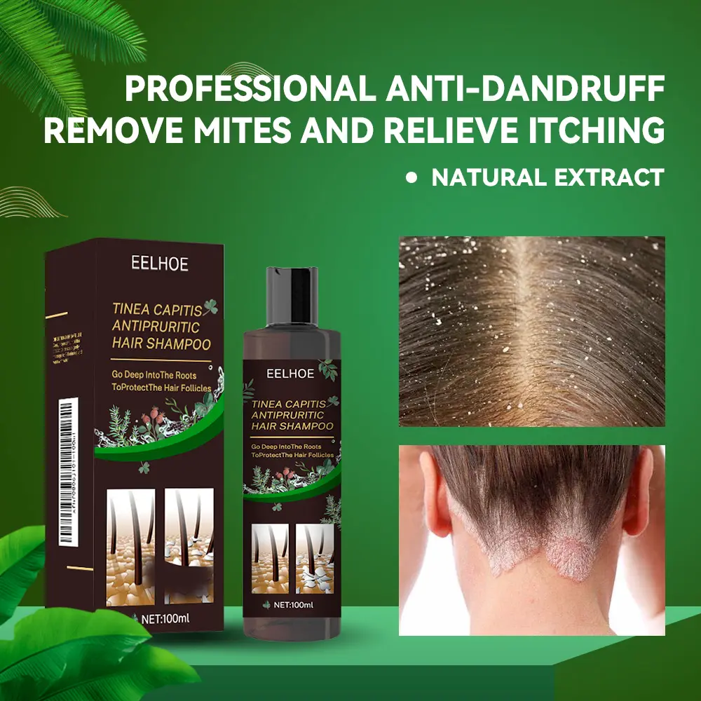 (Buy 1 get 1 free) Psoriasis Shampoo, Seborrheic Dermatitis Shampoo, Folliculitis Shampoo, Anti-Fungal Shampoo for Dandruff, 100ml