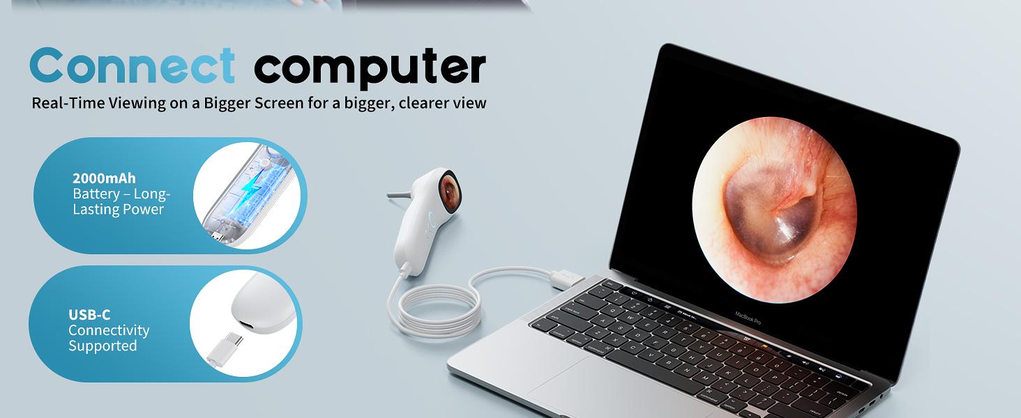 Otoscope Ear Camera with 1.21” Screen, 1080P Ear Scope with 4 LED Lights, Otoscope Camera for Adults Kids and Pets, Support Photo & Video, Type-C Charging with Computers, Baby Essentials, Home Medical