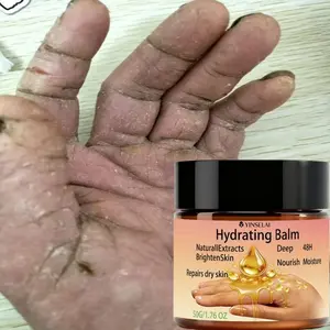 Moisturizing Hand Cream, Gentle and Effective, Nourishes Dry Hands, Reduces Redness and Itching, Smooths and Tightens Skin