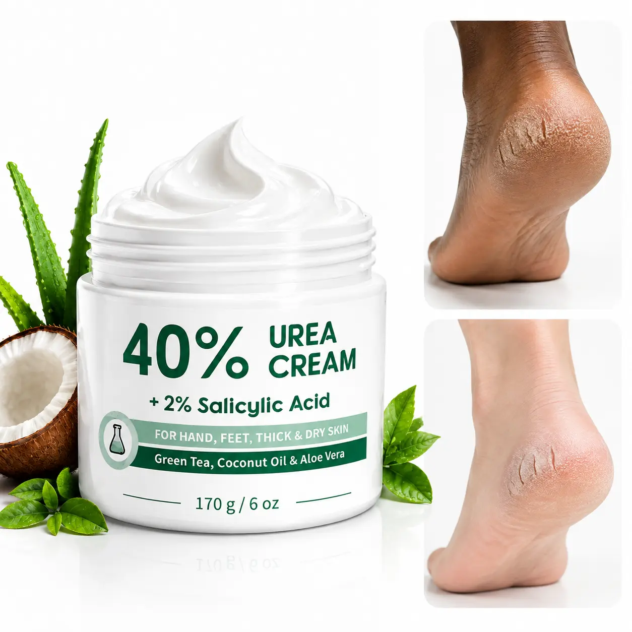 40% Urea Foot Cream with 2% Salicylic Acid, Maximum Strength 6 oz (170g) Callus Care for Dry Cracked Heels, Fast-Absorb Daily Apply Moisturizer with Hydration Boost for Hands, Elbows, Knees, Ankles