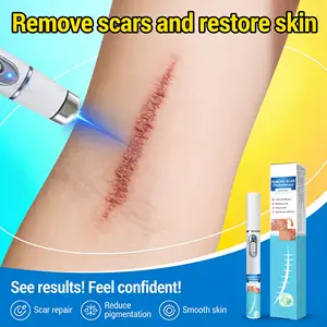 At-Home Laser Device for Scars & Marks | Visibly Helps Improve the Appearance of Acne Scars & Skin Imperfections | Professional-Grade Care for Smoother Skin | Safe & Non-Invasive Radiant