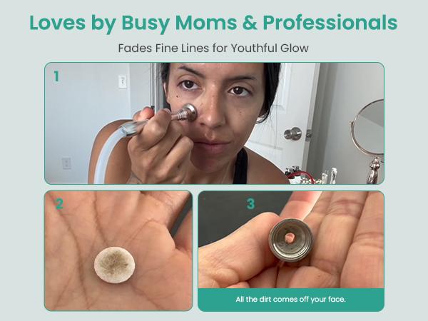 UNOISETION Diamond Microdermabrasion Machine- 3 in 1 Professional Facial Microdermabrasion Tool for Exfoliation & Blackhead Removal for Home Use Skin Care, Reduces Fine Lines, Boosts Serum Absorption