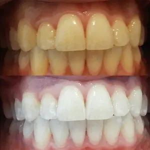 TOOTHKILL - Toothache Oil