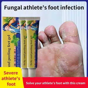 Miao's Athlete's Foot Cream: Relieves itching, removes peeling, kills fungi, stops foot itch, deodorizes, repairs cracked feet, treats blisters between toes and eliminates foot odor.
