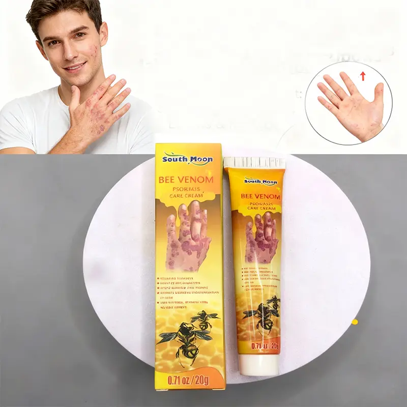 Soothing Itch Relief Cream - Ideal for Eczema, Minor Skin Rashes & Irritations