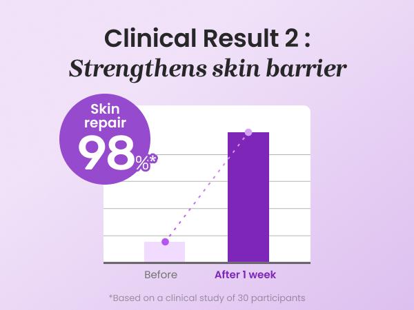 PDRN Active Boost Face Serum - Salmon DNA Serum for Face, Smoothing Fine Lines & Wrinkle, Rejuvenating & Firming Skin, Anti-aging Booster with Collagen, Korean Skin Care, 1.01 fl. oz. (30ml)