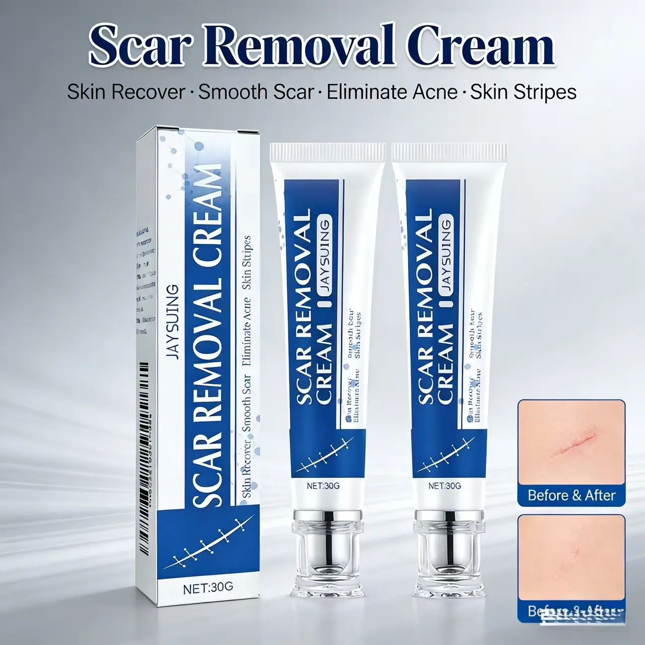 Advanced Silicone Scar Removal Gel - Professional Skin Care Solution for Surgical Scars, C-Section, Keloid Bump (1.06 oz/30g), Scar Removal Gels