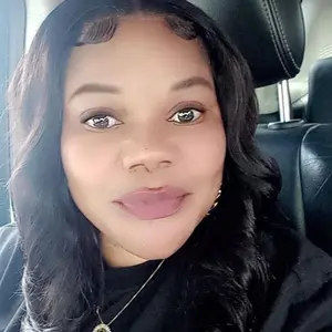 Product Review of The Ordinary Glycolic Acid 7% Exfoliating Toner, Brightening and Smoothing Daily Toner for More Even-Looking Skin Tone from M**e