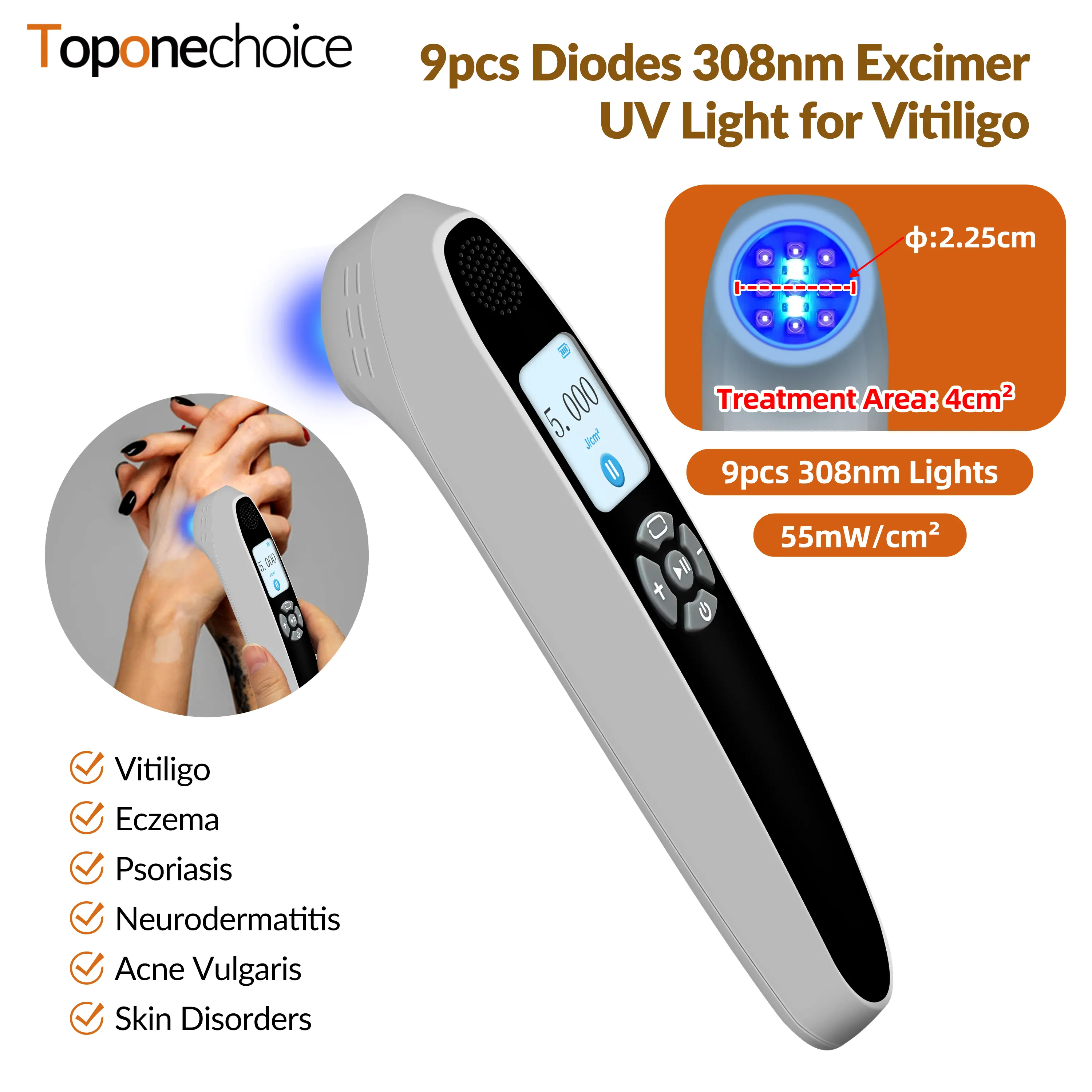 Toponechoice 6 Diodes 308nm UVB Excimer Phototherapy Device, 55mW/cm² High Energy Density, Handheld Blue Light Skin Treatment, Targeted Therapy for Vitiligo, Psoriasis, Eczema, Atopic Dermatitis, Portable Home Use for Skin Disorders