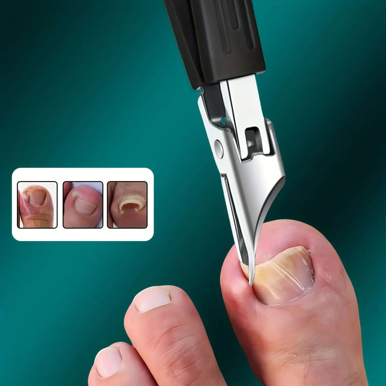 For Thick & Ingrown Toenails - Heavy-Duty Stainless Steel Precision Trimmer with Safety & Soft Grip, Ultra-Sharp 25° Beveled Blade - Elderly-Friendly Nail Clipper for Thick Nails, Anti-Splash Design (for/arthritic Hands & Feet)