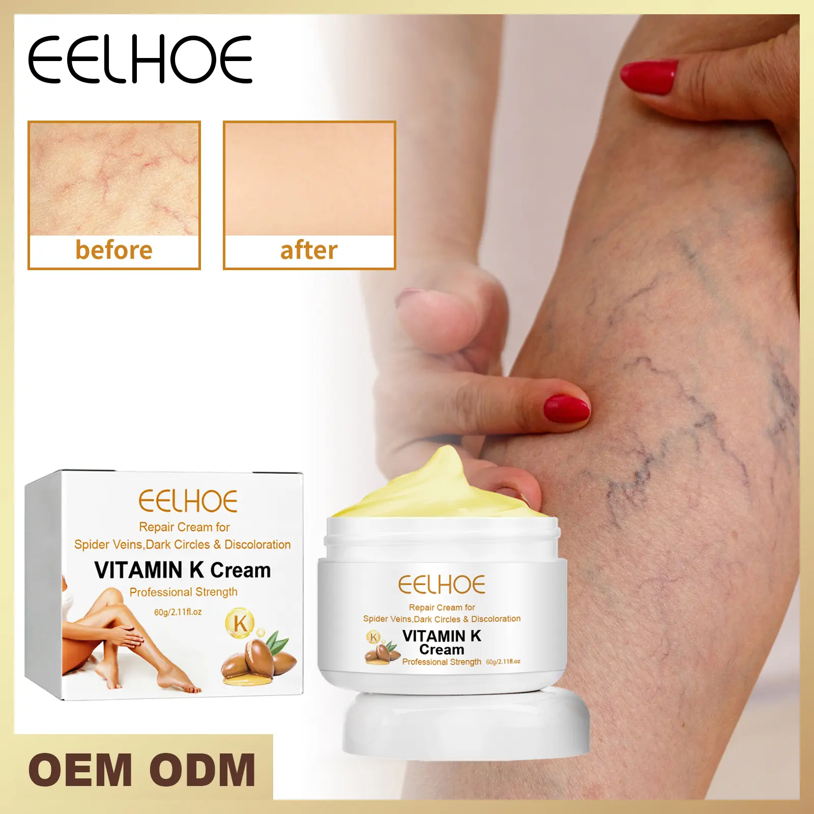 Pro-Vein Vitamin K Treatment Cream｜Corrects Circulation & Visible Veins｜Intensive Relief for Heavy Legs｜Rejuvenating Massage Complex Body Care Daily Horse Moisturizer Sensitive Comfort Moisture Hydrating Cosmetic Moisturizing