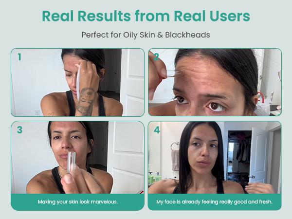 UNOISETION Diamond Microdermabrasion Machine- 3 in 1 Professional Facial Microdermabrasion Tool for Exfoliation & Blackhead Removal for Home Use Skin Care, Reduces Fine Lines, Boosts Serum Absorption