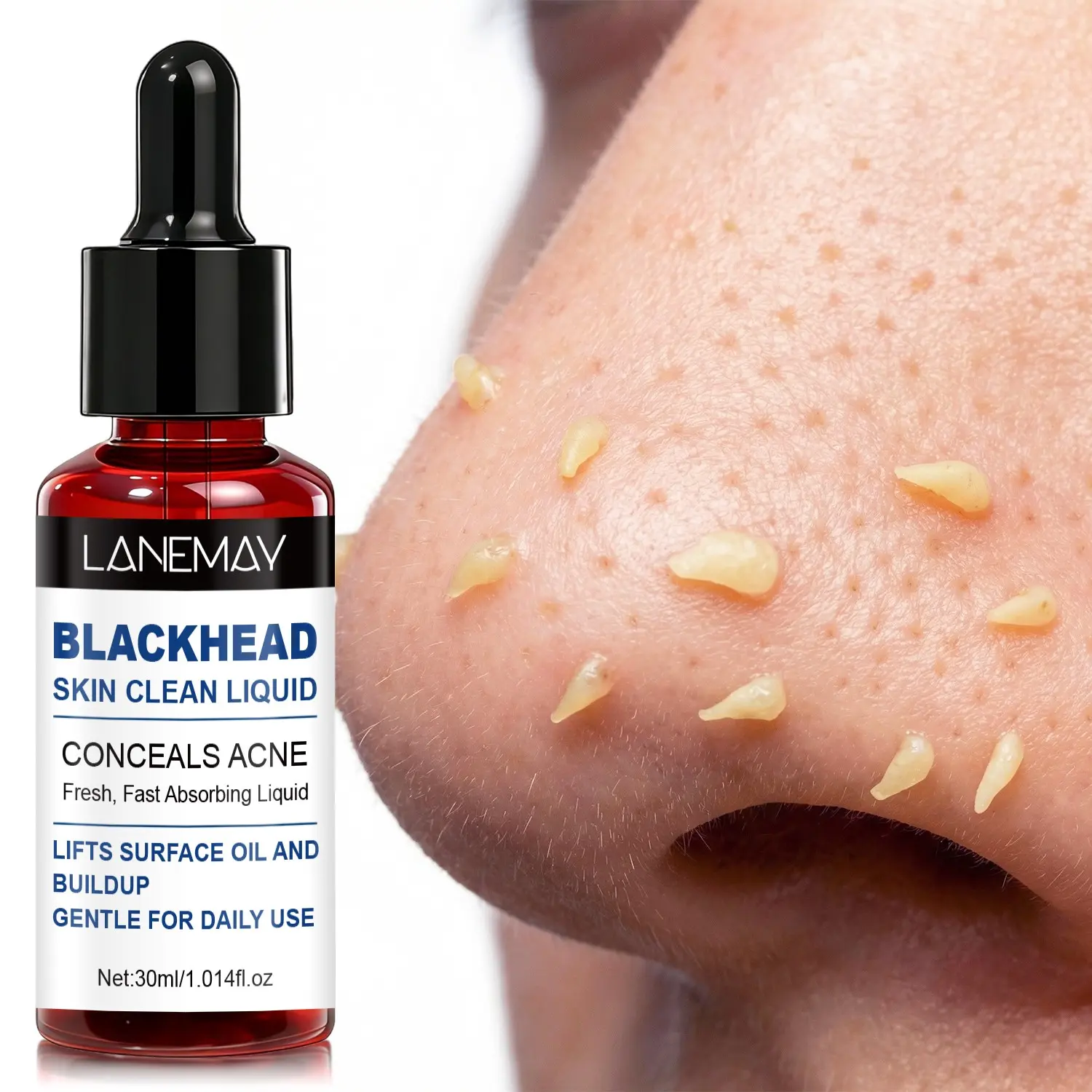 30ml Multi-Acid Blackhead Cleanser, Acne Serum, Blemish Relief, Salicylic Acid + Succinic Acid + Niacinamide + Lactobionic Acid softens blackheads and fades blemishes, Gentle formula suitable for daily use, improves roughness, and refines skin
